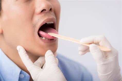 Swollen Taste Buds Causes Diagnosis And Treatment