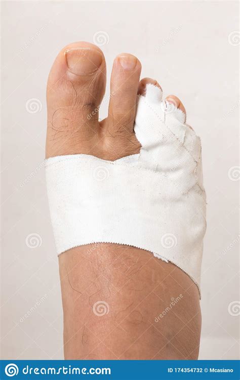 Mans Bandaged Up Broken Toe Stock Photo Image Of Aging Joint 174354732