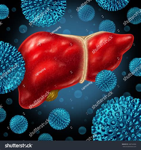 21 Hapatitis Images Stock Photos And Vectors Shutterstock
