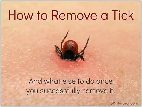 How To Remove A Tick And What To Do Once Youve Been Bitten