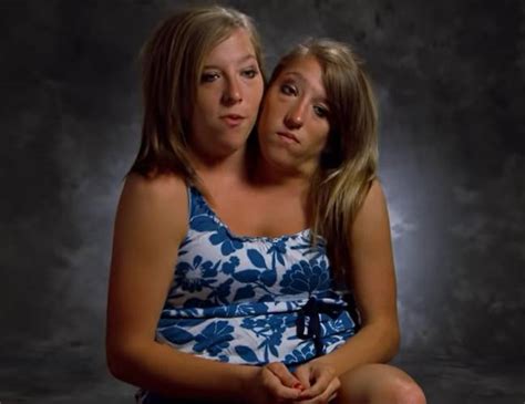 conjoined twins opened up on what their life was like after becoming teachers