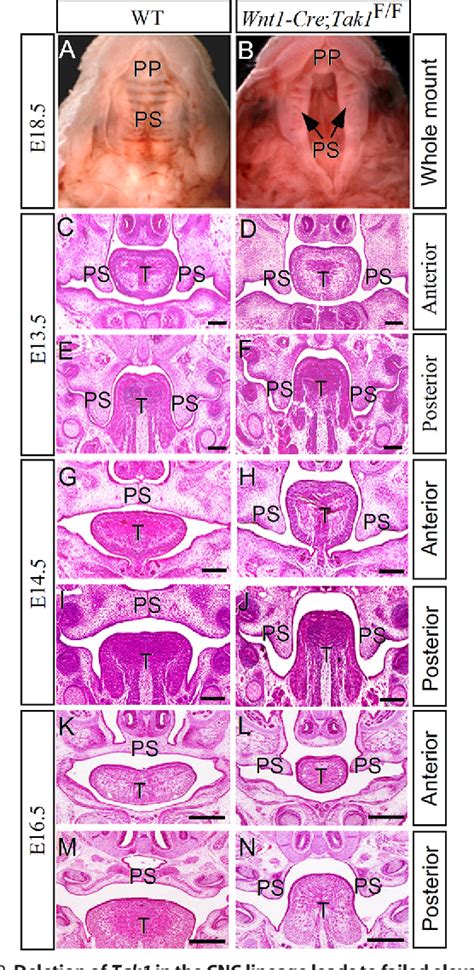 Figure 2 From Mice With Tak1 Deficiency In Neural Crest Lineage Exhibit
