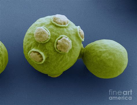 Yeast Cells Sem Photograph By Eye Of Science Fine Art America