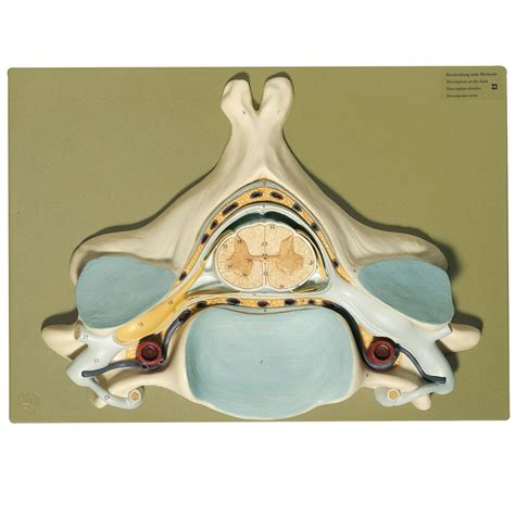 Cervical Vertebrae Model With Spinal Cordanatomical Spinal Nerves Porn Sex Picture
