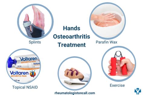 How To Treat Hand Osteoarthritis At Home Rheumatologist Oncall