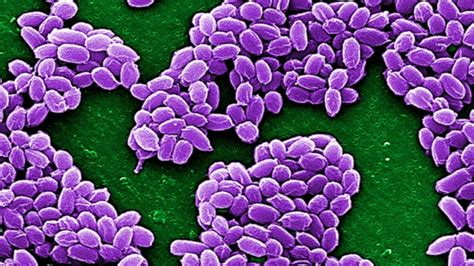 What You Need To Know About Anthrax Infections Abc News