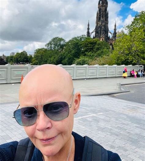 Scots Tv Host Gail Porter Told She Could Be Pretty Again If She Wore A Wig