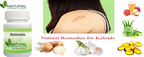Get Complete Treatment Of Keloids With Natural Remedies