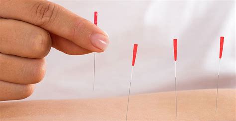 Milton North Acupuncture Massage Addict