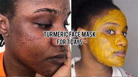 I Tried The Turmeric Face Mask For Days Realistic Results Sarah