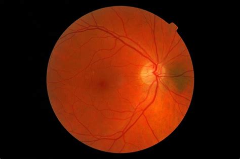 Retinal Recognition The Ultimate Biometric
