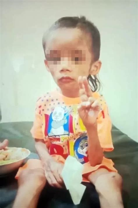 Miris Bocah 7 Tahun Disiksa Dan Tak Diberi Makan Ayahnya Ketua Rt