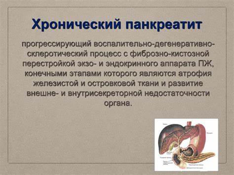 Диета для панкреатин Панкреатин Болезнь Симптомы Лечение Диета — Похудение Диета Правильное Панкреатин Болезнь Симптомы Лечение Диета — Похудение Диета Правильное Диета для панкреатин