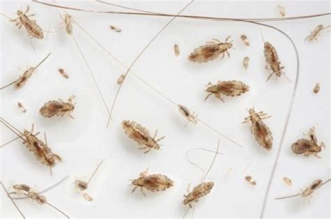 Body Lice Originate From Head Lice Sciencedaily