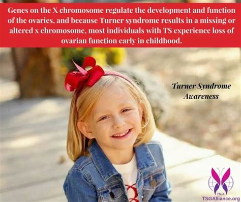 Pin By Karen Johnson On Turner Syndrome Turner Syndrome Awareness Turner Syndrome Ovarian