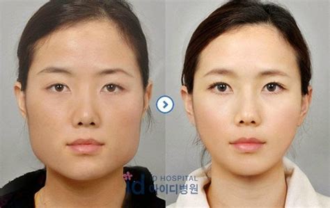 Korean Plastic Surgery Part 2 ~ Damn Cool Pictures
