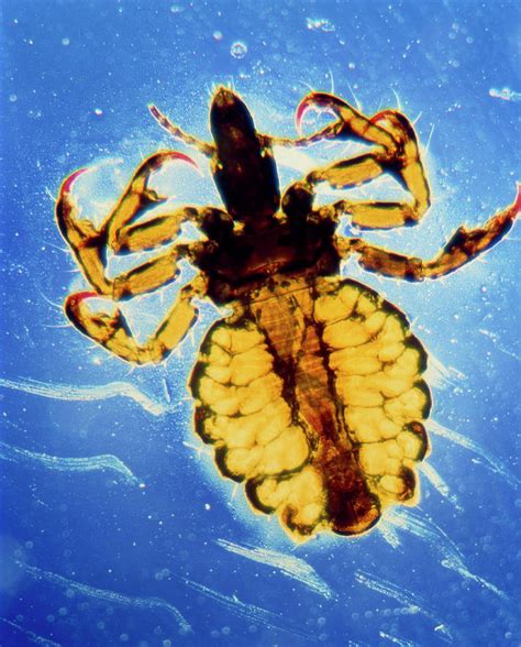 Lm Of Human Body Louse Photograph By Stevie Grandscience Photo Library