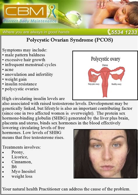Polycystic Ovarian Syndrome Correct Body Maintenance