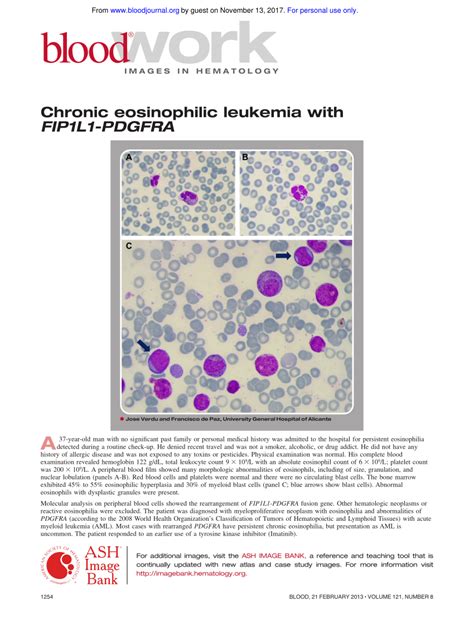 Pdf Chronic Eosinophilic Leukemia With Fip1l1 Pdgfra