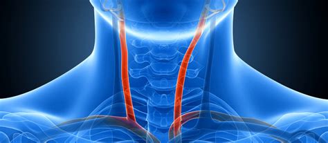 Carotid Duplex Rapid Diagnostics