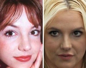 Britney Spears Plastic Surgery Before And After Photos Celeblens Com