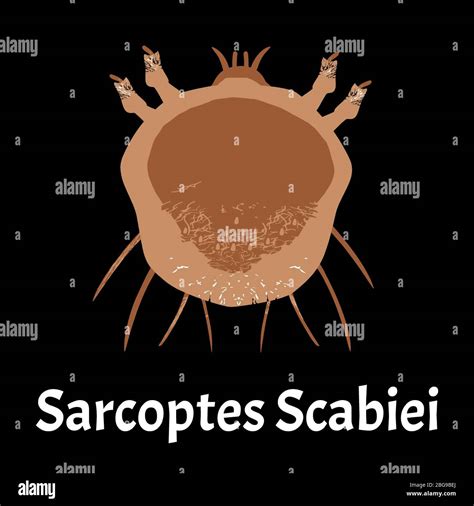 Sarcoptes Scabiei Scabies Sexually Transmitted Disease Infographics