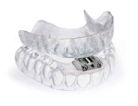 Tap 3 Device For Treatment Of Sleep Apnea Burbank Dental Lab