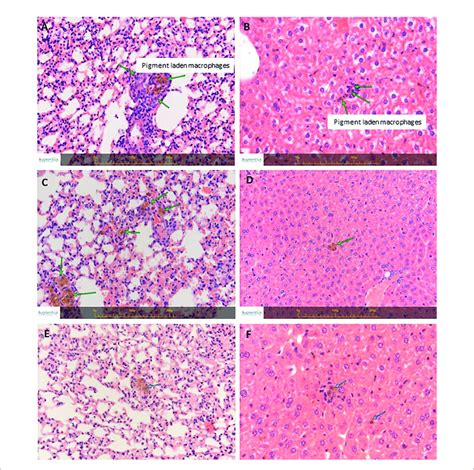 hande staining of lungs and livers from naïve balb c treated mice a download scientific