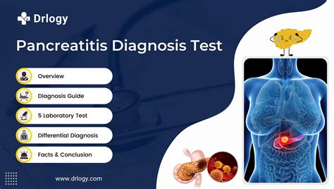 5 Essential Tests For Pancreatitis Diagnosis For Health Drlogy