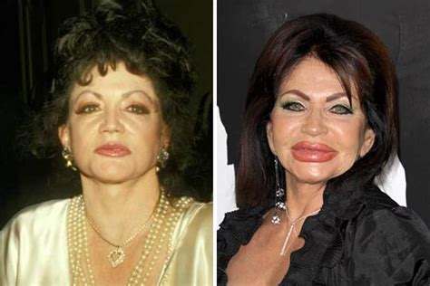 Top 10 Celebs That Became Super Ugly After Plastic Surgery Womans Era