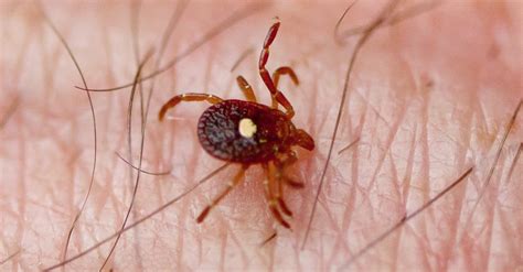 Fact Check Can The Bite Of A Reverse Zombie Tick Make You Allergic