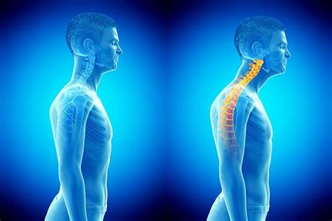 Posture Correction How To Fix Bad Posture Physiocore