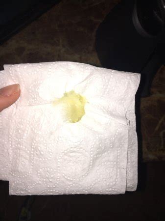 Well i examined my kitty's bottom this evening, and i noticed that she had yellow discharge, and i'm assuming this is the mucus plug. Semen vs. Mucus Plug - Page 2 - BabyCenter