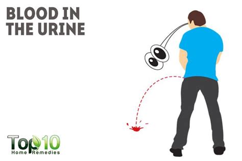 Uterine cancer may also cause other symptoms, such as pain or pressure in your pelvis. Signs and Symptoms of Prostate Cancer that You Must Know ...