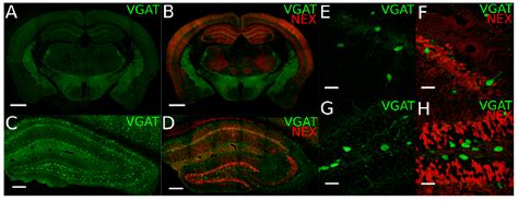 Ijms Free Full Text Bdnf Expression In Cortical Gabaergic Interneurons
