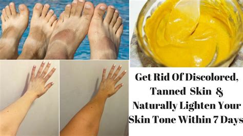 how to get rid of uneven discolored and tanned skin within 7 days get fair skin naturally youtube