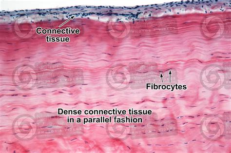 Mammal Tendon Longitudinal Section 125x Tendons And Ligaments