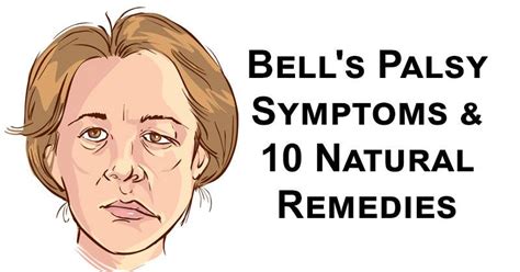 Check spelling or type a new query. 10 Natural Remedies for Facial Paralysis - Bell's Palsy | Bells palsy, Facial nerve, Bell's ...