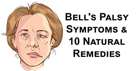 Bell's palsy is a condition where one side of your face droops or feels weak. 10 Natural Remedies for Facial Paralysis - Bell's Palsy ...