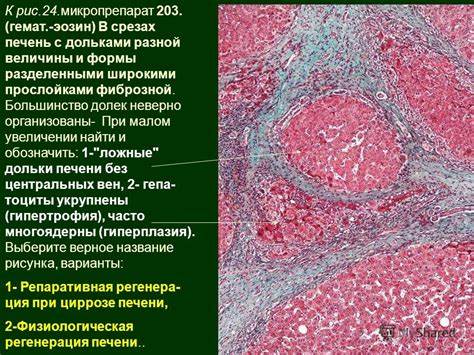 Хронический вирусный гепатит в диета Презентация на тему: "Тема : Компенсаторно Приспособительные Процессы Презентация на тему: "Тема : Компенсаторно Приспособительные Процессы Хронический вирусный гепатит в диета