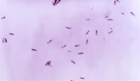 Biol 230 Lab Manual Gram Stain Of Clostridium Perfringens