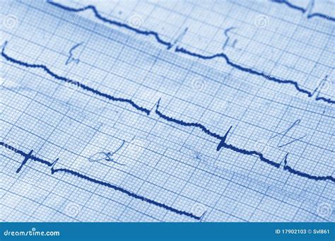 Cardiogram Stock Image Image Of Blue Line Health Examination 17902103