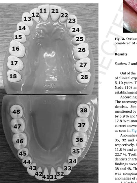 Dental Teeth Images