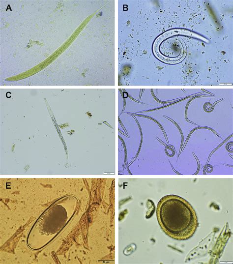 Diagnostic Stages Of Less Common Nematodes Of Livestock A