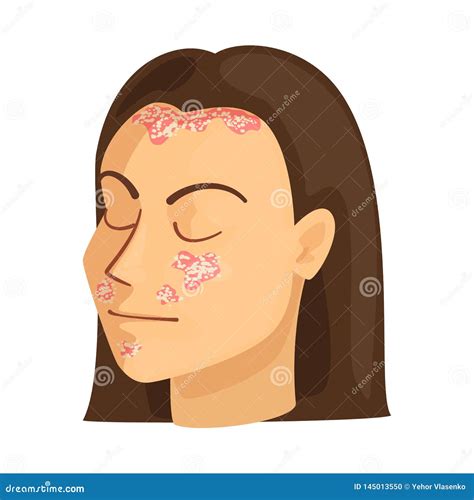 Psoriasis Skin Disease On Cartoon Vector 152300181