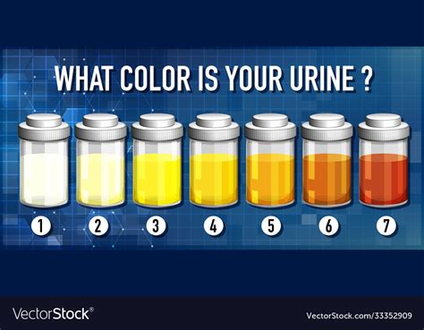 Colors Of Urine Chart Printable