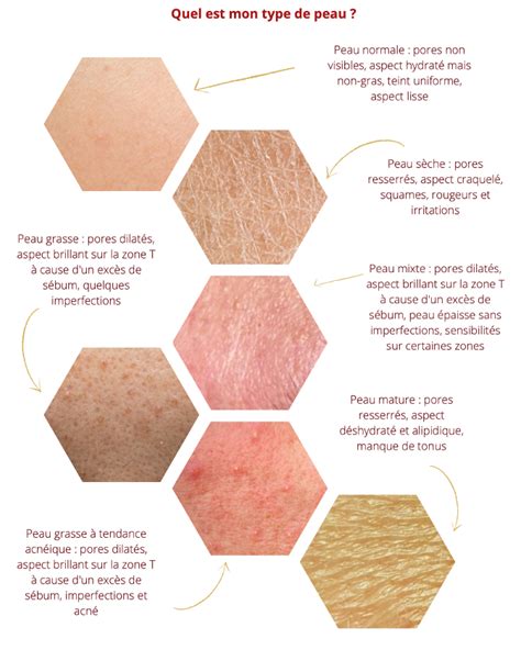 Connaître Son Type De Peau Le Guide Complet Carroussel Beauté