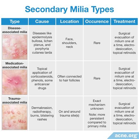 What Are Milia And Do They Relate To Acne