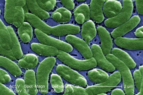 Vibrio Bacteria Cases Not A ‘harbinger Doc Says Wgcu Pbs And Npr For