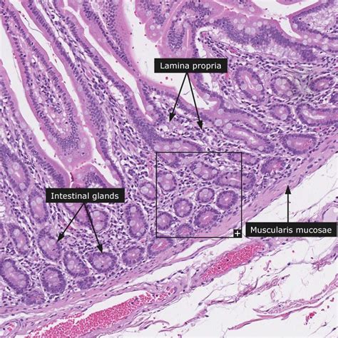 Small Intestine Histology Labeled Lab Practical Pics Human Anatomy